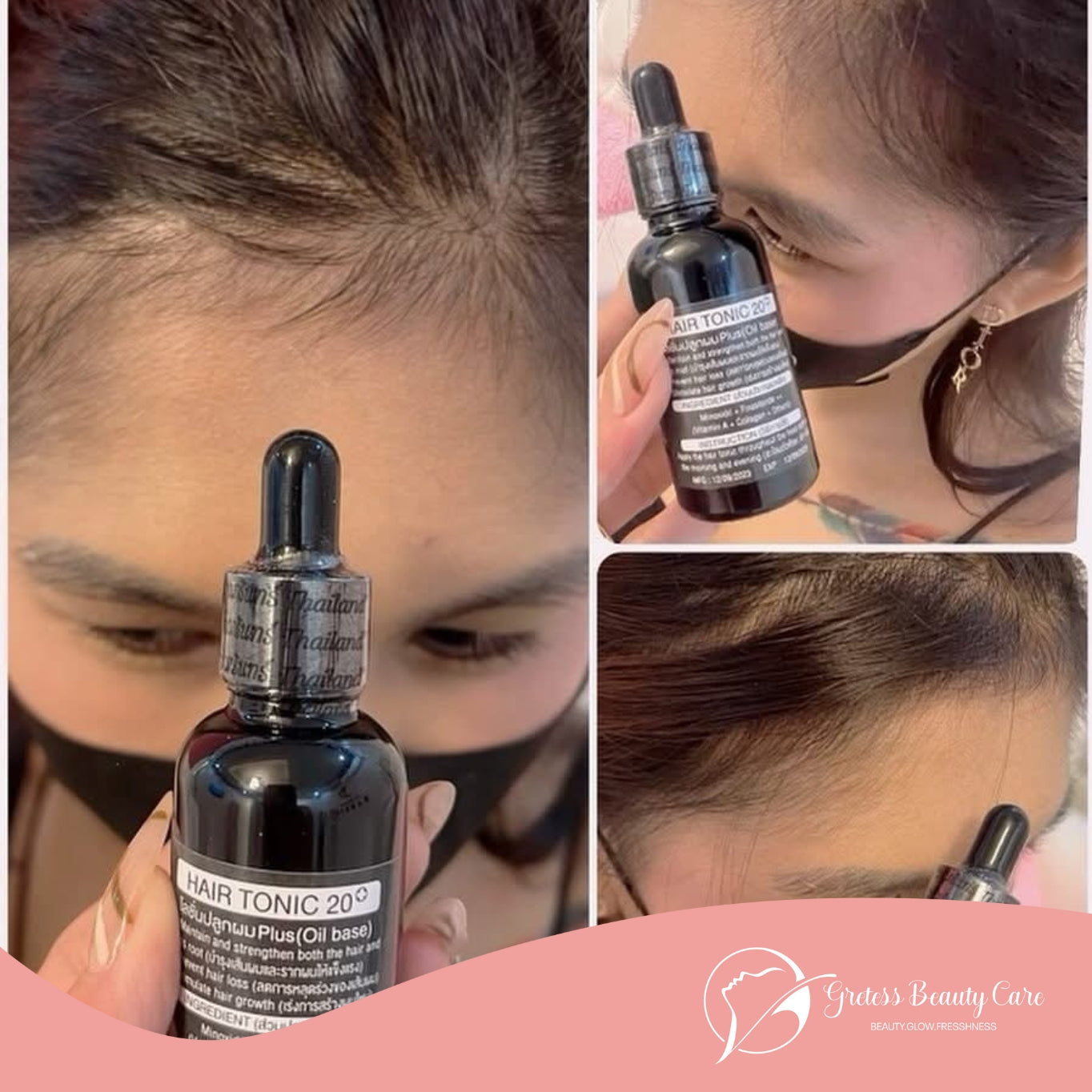 Minoxidil 20% By Fairy God Barbie
